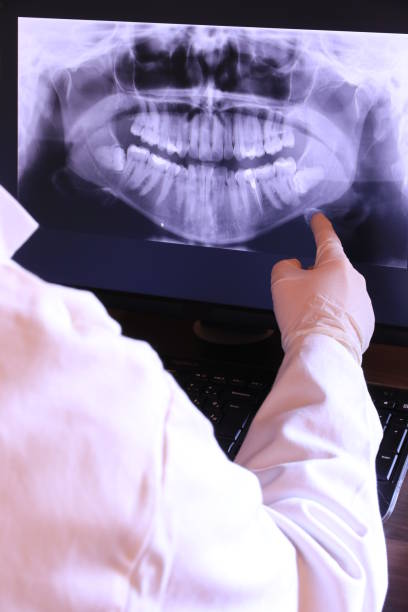 Best Emergency Dental Care for Abscessed Tooth in Mount Zion, GA