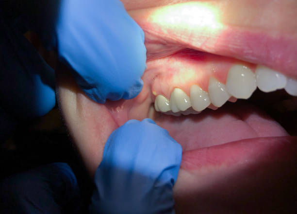 Best Urgent Dental Care for Toothache in Mount Zion, GA