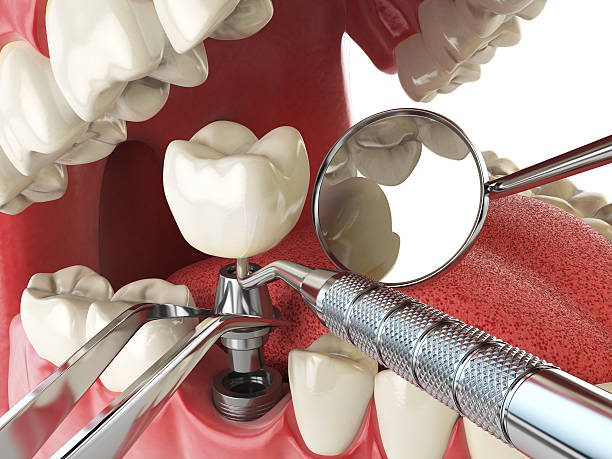 Best Orthodontic Emergency Dentist in Mount Zion, GA